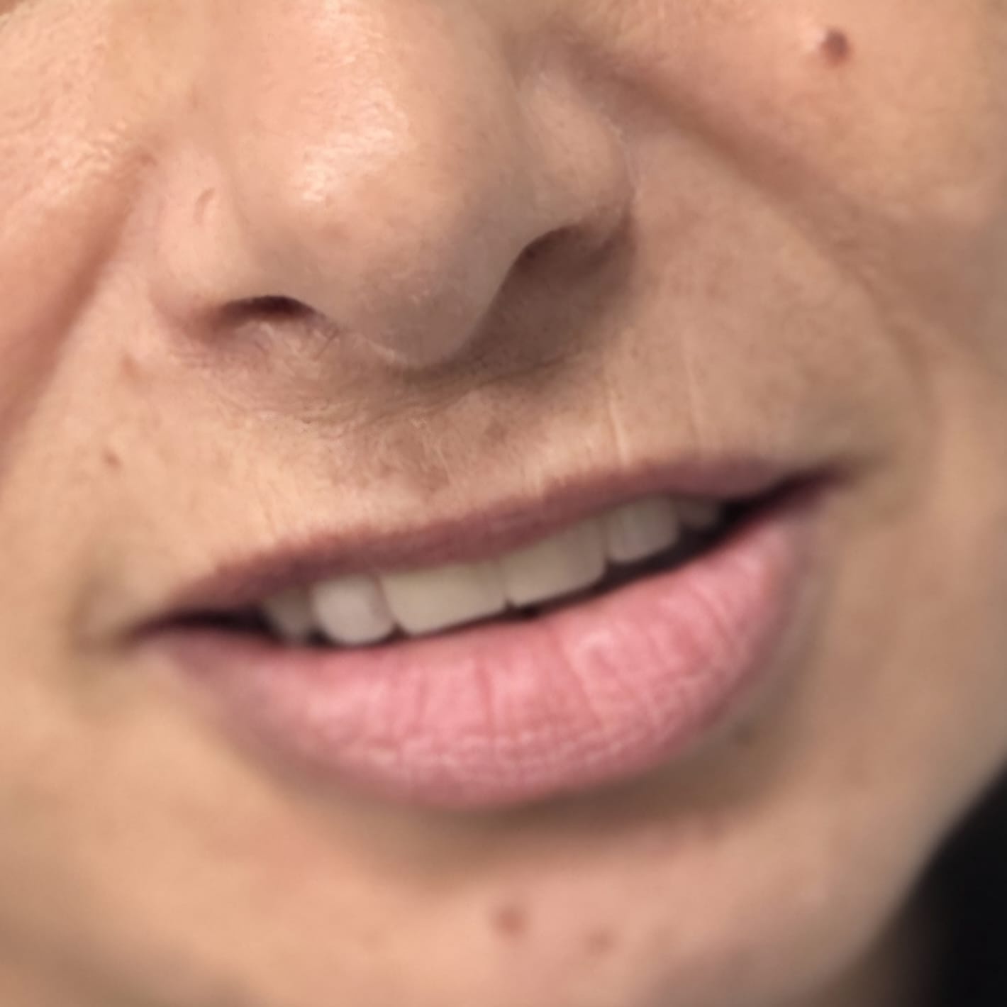 reabilitare-3