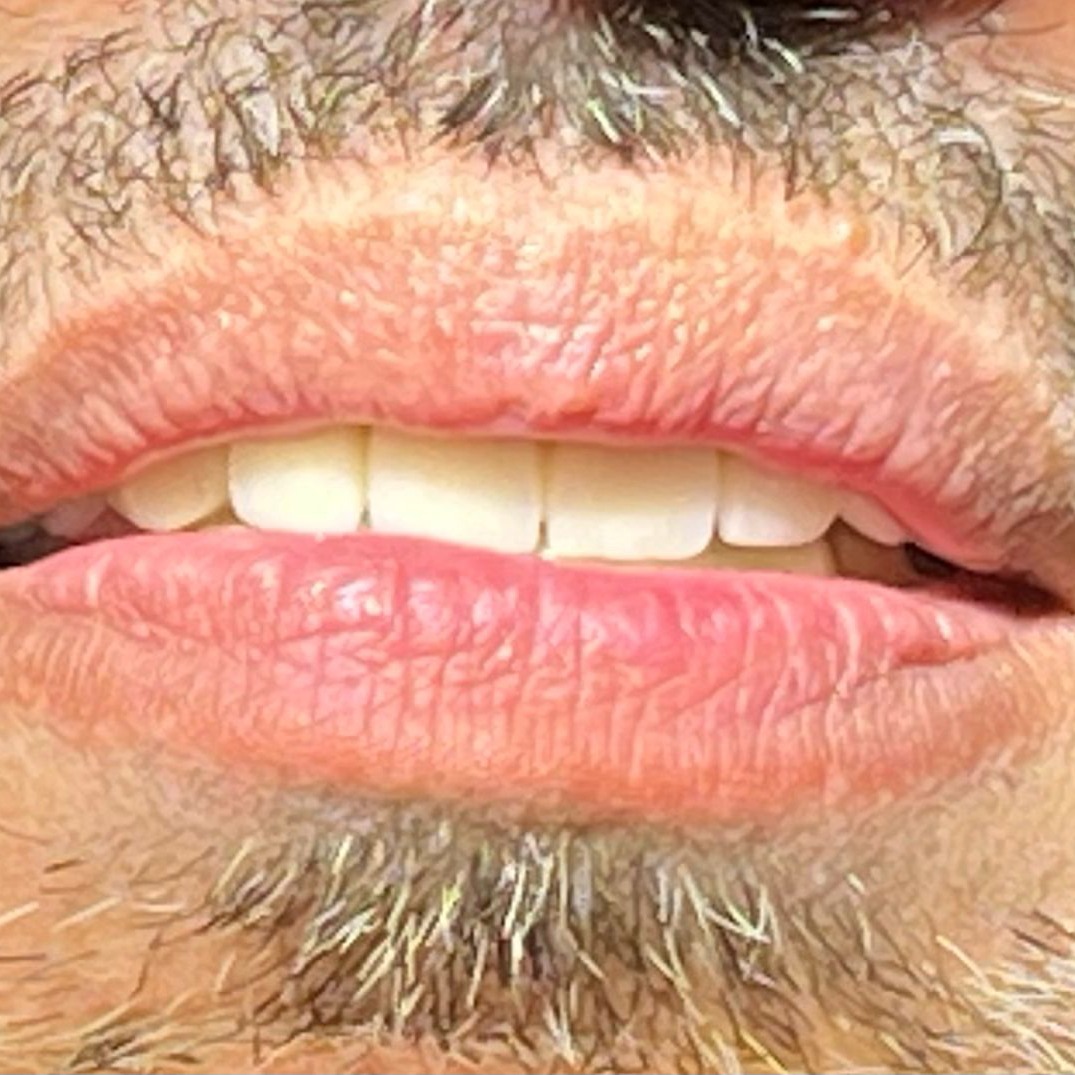 reabilitare-9